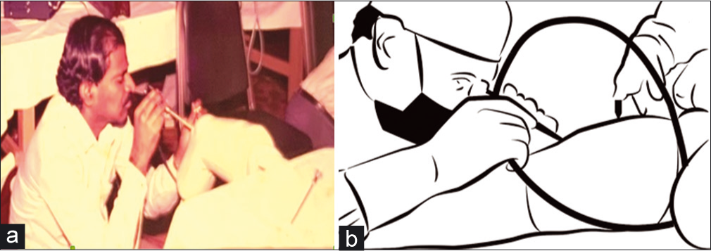 (a) 1988 Chennai workshop hands on sessions on model. (b) Diagrammatic representation of surgery being performed by direct viewing.