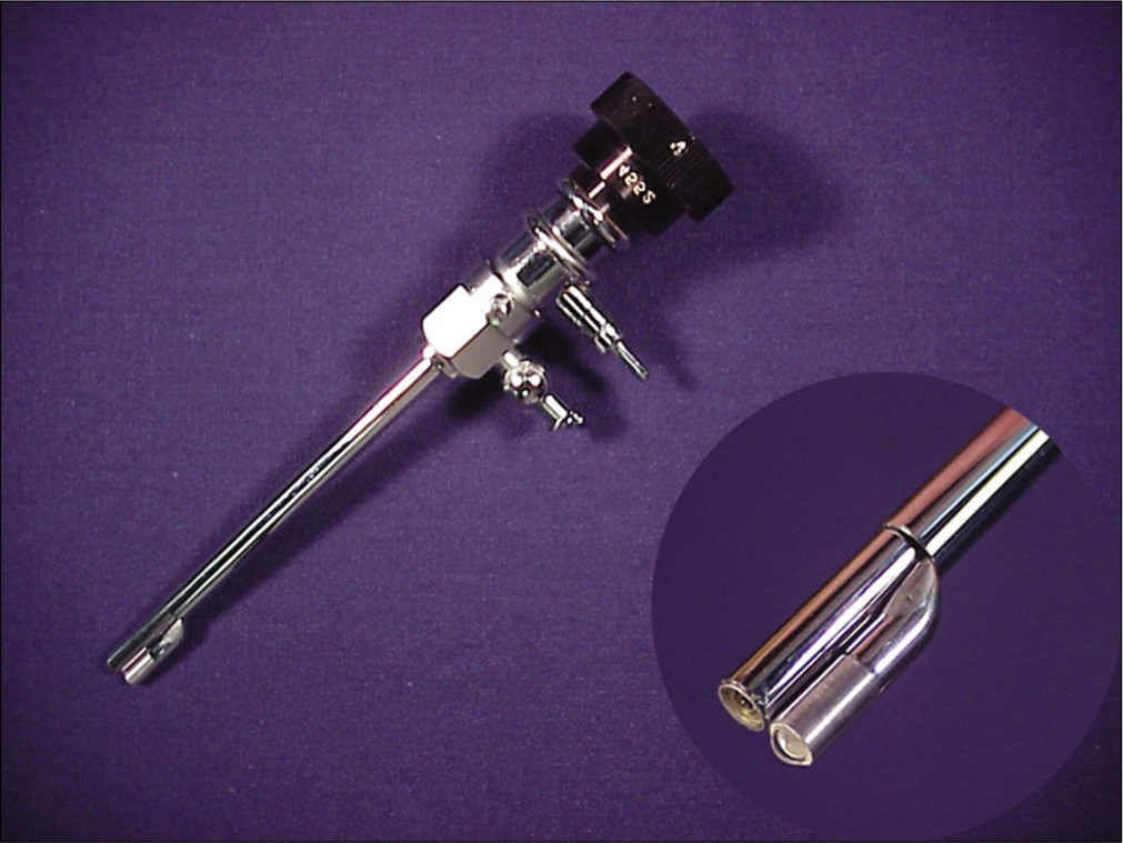 The Watanabe No. 21 was the first production arthroscope and had optics that brought its field of view close to that of the human eye. Courtesy Gary Poehling.