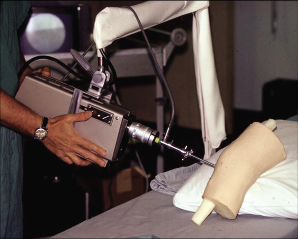 An early camera, shown in use with a knee arthroscopy teaching model (1975). Courtesy Gary Poehling.