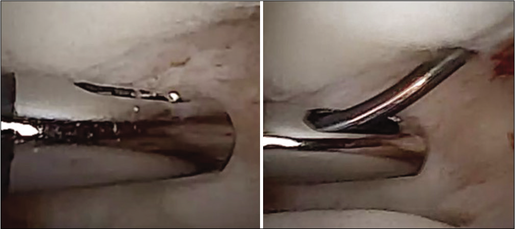 “Peekaboo” probe used in NanoScope™ procedures, which allows insertion of instrument and probing of a surface in a different plane.