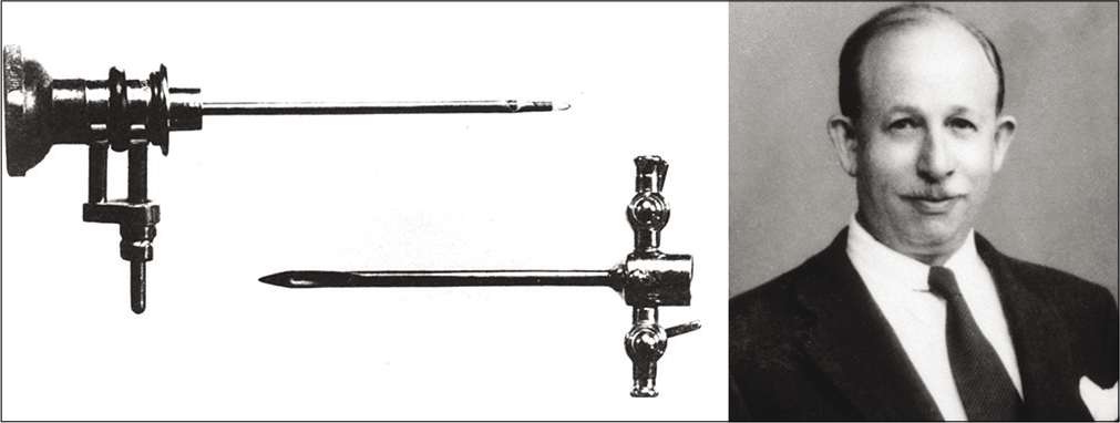 Dr. Michael Burman and his arthroscopy equipment. The upper portion is the telescope (3 mm diameter), and lower portion is the trochar sheath (4 mm diameter). Source: Byrd 2013 – Springer “Overview and History of Hip Arthroscopy” in book “Operative Hip Arthroscopy” ISBN 978-1-4419-7925-4.