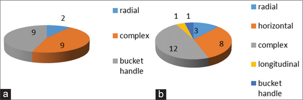 Pattern of meniscal injuries (a) pattern of medial meniscus tear (b) pattern of lateral meniscus tear.