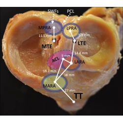 Article figure