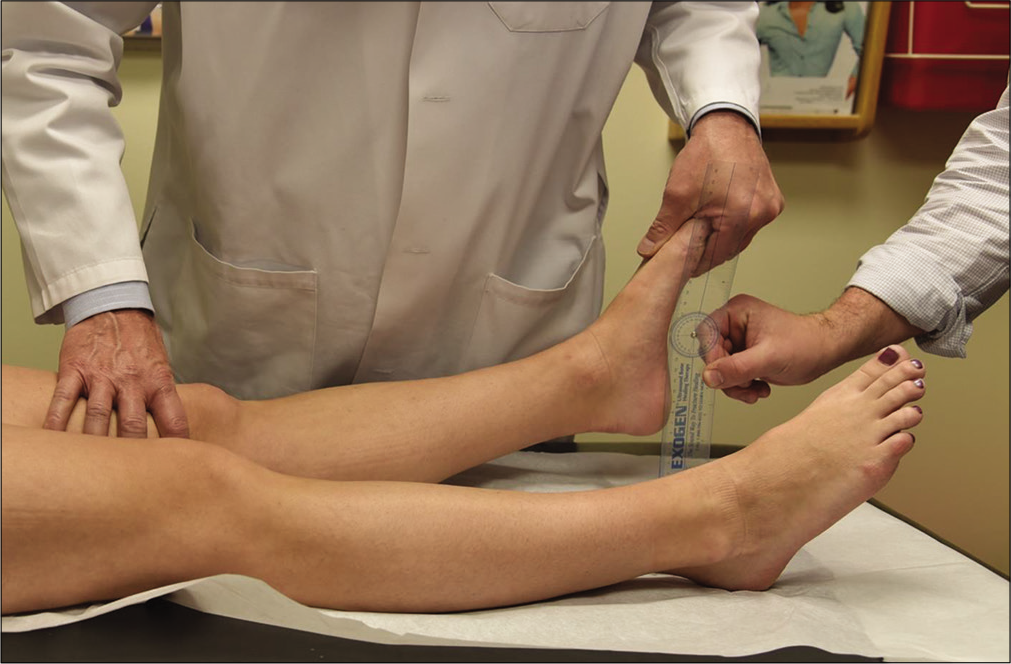 The external rotation recurvatum test takes advantage of the increased heel height seen in patients with posterolateral corner (PLC) injuries. Historically used to grade PLC tear severity, the heel height test now is now understood to indicate the presence of a combined anterior cruciate ligament (ACL) and PLC injury. A side-to-side difference in heel height of 2.5 cm indicates a combined ACL/FCL tear. As the distal thigh is stabilized with one hand and the foot lifted by the great toe with the other, a knee with a combined PLC and ACL injury will demonstrate an increased heel height as the tibia undergoes anterior subluxation and slips into external rotation.