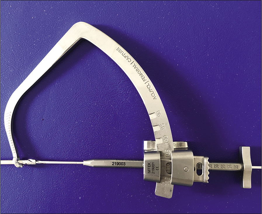 Standard outside-in femoral jig.