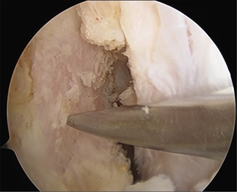 Creating a pilot hole using an awl.