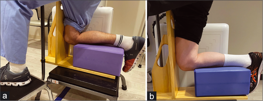 Setup for kneeing Posterior Stress Radiographs: Posterior stress radiographs are an important tool for determining the integrity of the posterior cruciate ligament (PCL) in patients presenting with multiple ligament injuries. In chronic patients with an injury to the PCL, kneeling posterior stress radiographs can also determine whether the PCL healed in an attenuated position, rendering it nonfunctional. (a) Radiographs are taken by having the patient kneel on the injured leg, with the contralateral leg planted forwards, out of the way of the X-ray shot. The patient should have a bar or surface to hold for stability. (b): The patient’s kneeling leg is flexed, with the lower leg on a foam block and the tibial plateau just at the edge of the block. The patient’s weight falls through the femur and tests the integrity of the PCL. The radiographic difference is compared to the uninjured side to determine the side-to-side difference.