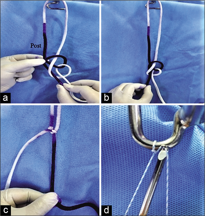 A new arthroscopic sliding locking knot: Banarji knot - Journal of ...