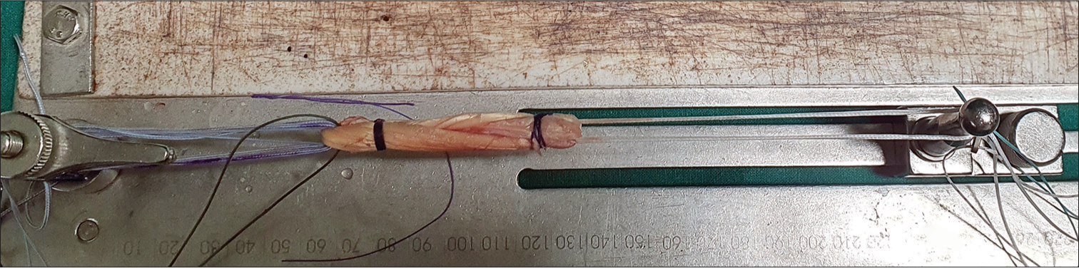 The graft is sutured at both ends to make it a single incorporated graft and tensioned on the graft preparation board.