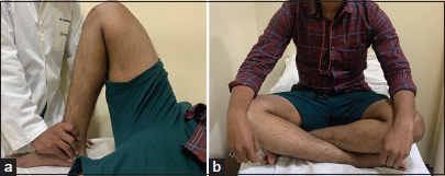 (a) Full range of motion at 6 months postoperatively in a sample patient and (b) same patient sitting cross-legged at 6 months post-surgery.