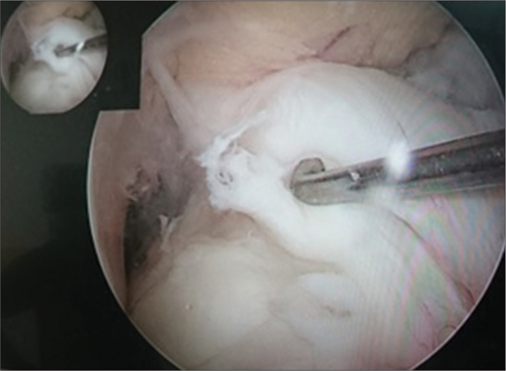 Anterior cruciate ligament knee laxity assessments.