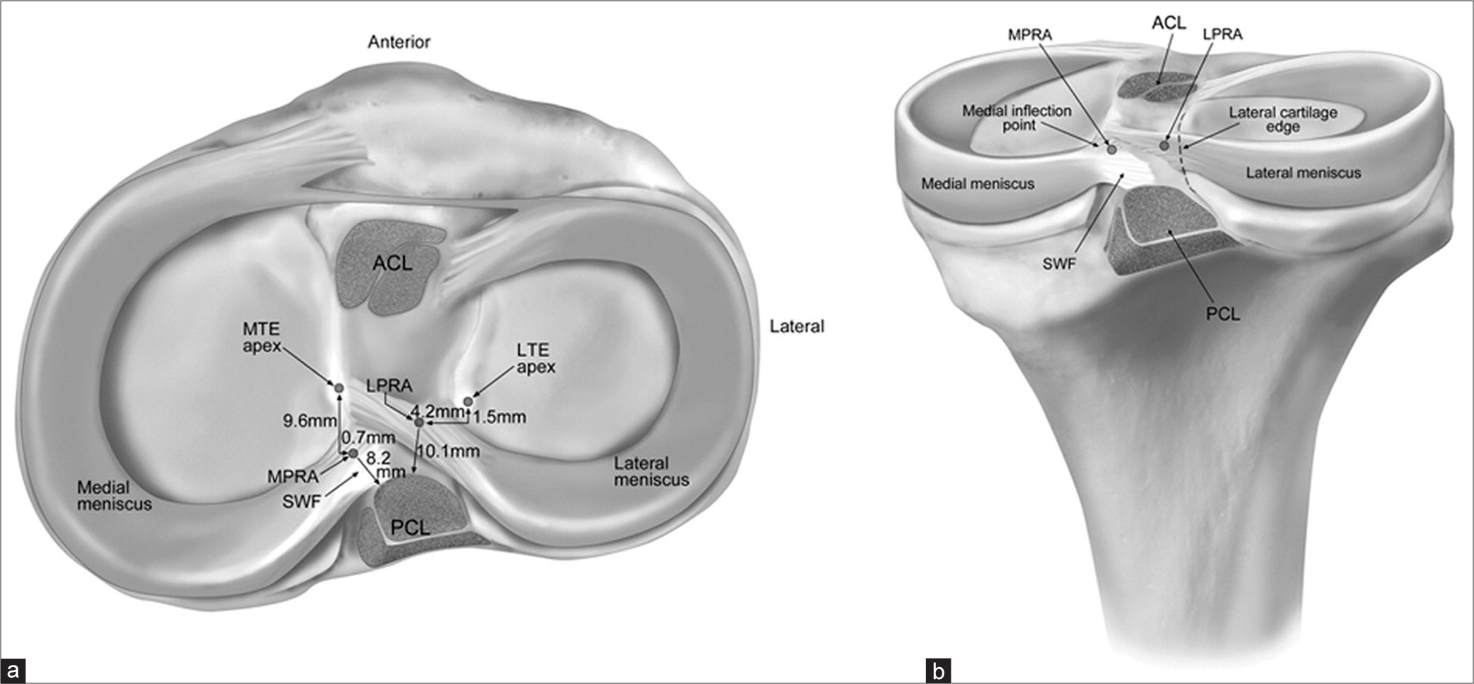 Illustration demonstrating the medial and lateral meniscal posterior root attachments and relevant arthroscopically pertinent anatomy (right knee). (a) Superior view and (b) posterior view. ACL: Anterior cruciate ligament, LPRA: Lateral meniscus posterior root attachment, LTE: Lateral tibial eminence, MPRA: Medial meniscus posterior root attachment, MTE: Medial tibial eminence, PCL: Posterior cruciate ligament, SWF: Shiny white fibers. Figure used with permission from Johannsen et al.[15]