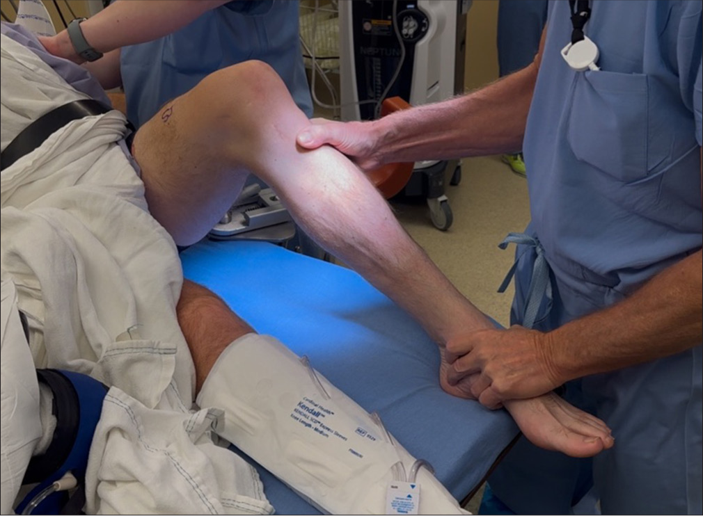 The posterior sag test is conducted with the patient lying supine and the knee flexed to 90°. The examiner evaluates the alignment of the medial tibial plateau (MTP) in relation to the medial femoral condyle (MFC), either by visual inspection from the side or by palpating the joint line. Under normal conditions, the MTP sits approximately 1 cm anterior to the MFC; any noticeable posterior displacement indicates a posterior cruciate ligament (PCL) deficiency. In the quadriceps active test, the examiner stabilizes the patient’s ankle while monitoring tibial alignment. The patient is asked to contract the quadriceps muscles, and an anterior tibial shift exceeding 2 mm during contraction confirms the presence of PCL insufficiency.