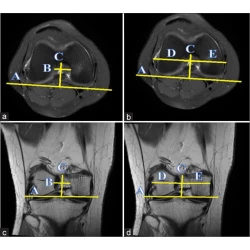 Article figure