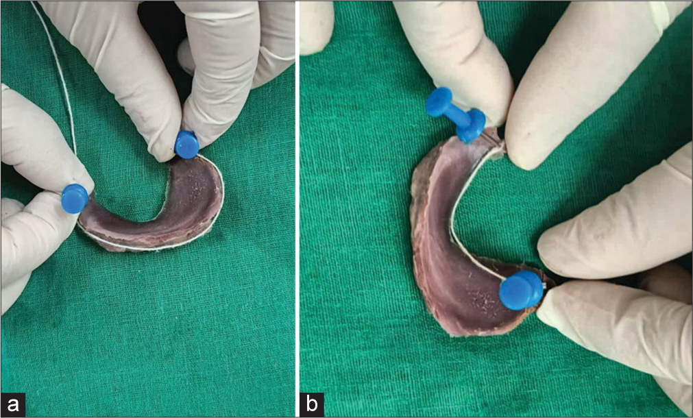 (a) Measurement of ‘outer circumference’ of a meniscus using pins and flexible threads. (b) Measurement of ‘inner circumference’ of a meniscus using pins and flexible threads.